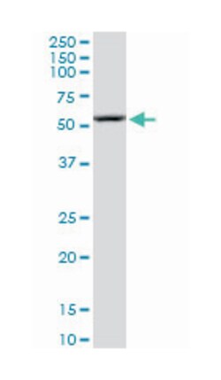 Rho GTPase activating protein 1, Mouse, Polyclonal Antibody, Abnova 50 &mu;L | Buy Online | Abnova | Fisher Scientific