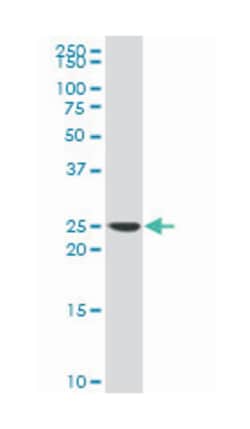 Rho GDP dissociation inhibitor (GDI) alpha (A02), Mouse anti-Human, Polyclonal