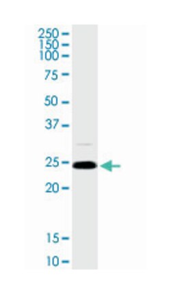 Rho GDP dissociation inhibitor (GDI) alpha (D03P), Rabbit anti-Human, Mouse, Purified MaxPab Polyclonal Antibody, Abnova 100 &mu;g | Buy Online | Abnova Corporation | Fisher Scientific