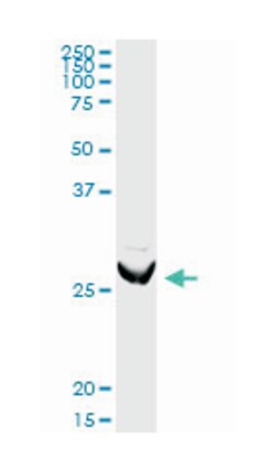 Rho GDP dissociation inhibitor (GDI) alpha (D03P), Rabbit anti-Human, Mouse, Purified MaxPab Polyclonal Antibody, Abnova 100 &mu;g | Buy Online | Abnova Corporation | Fisher Scientific