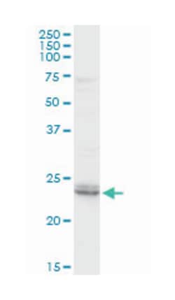 Rho GDP dissociation inhibitor (GDI) beta, Rabbit, Purified MaxPab Polyclonal
