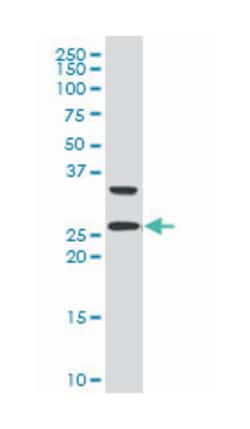 Rho GDP dissociation inhibitor (GDI) gamma (A01), Mouse anti-Human, Polyclonal Antibody, Abnova 50 &mu;L | Buy Online | Abnova Corporation | Fisher Scientific