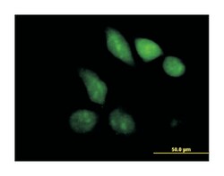 methyl-CpG binding domain protein 1, Mouse, Polyclonal Antibody, Abnova
