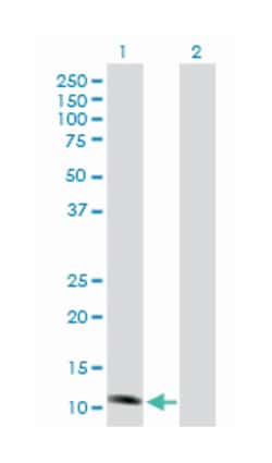 NADH dehydrogenase (ubiquinone) Fe-S protein 6, 13kDa (NADH-coenzyme Q