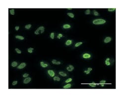 protein phosphatase 3 (formerly 2B), catalytic subunit, alpha isoform,