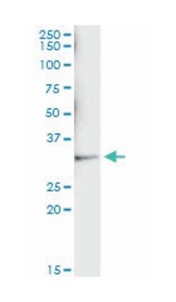 sulfotransferase family, cytosolic, 1A, phenol-preferring, member 1, Mouse, Clone: 1F8, Abnova 200 &mu;L | Buy Online | Abnova Corporation | Fisher Scientific