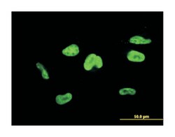 transcription elongation factor A (SII), 3, Mouse, Clone: 4E11, Abnova™