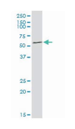 Rho guanine nucleotide exchange factor (GEF) 5, Rabbit, Purified MaxPab Polyclonal Antibody, Abnova 100 &mu;g | Buy Online | Abnova | Fisher Scientific