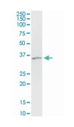 arrestin, beta 2, Mouse, Clone: 4D2, Abnova 100&mu;g; Unlabeled:Antibodies,