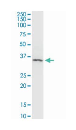 arrestin, beta 2, Mouse, Clone: 4D2, Abnova 100&mu;g; Unlabeled:Antibodies,