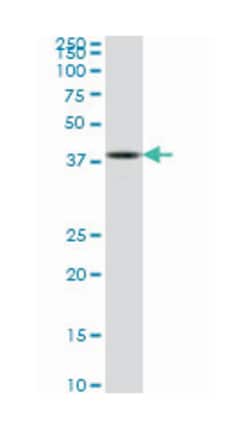 ASCL1, Mouse, Clone: 1C5, Abnova 100&mu;g; Unlabeled:Antibodies, Monoclonal