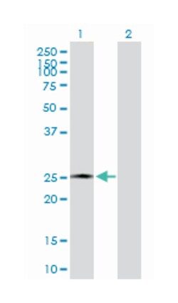 amelogenin (amelogenesis imperfecta 1, X-linked), Rabbit, Purified MaxPab