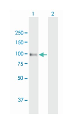AMPD2, Mouse, Polyclonal Antibody, Abnova 50&mu;g; Unlabeled:Antibodies,
