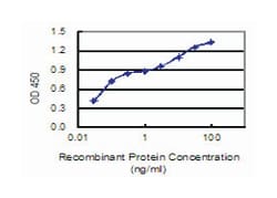 adenosine monophosphate deaminase 2 (isoform L), Mouse, Clone: 2F5, Abnova 50 &mu;g | Buy Online | Abnova Corporation | Fisher Scientific