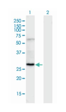 solute carrier family 25 (mitochondrial carrier; adenine nucleotide translocator),