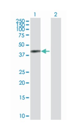 annexin A2, Rabbit, Purified MaxPab Polyclonal Antibody, Abnova 100 &mu;g | Buy Online | Abnova | Fisher Scientific