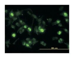 ANXA2, Mouse, Clone: 3E8-B6, Abnova 100&mu;g; Unlabeled:Antibodies, Monoclonal