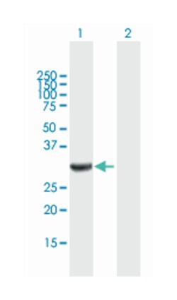 annexin A3, Mouse, Purified MaxPab Polyclonal Antibody, Abnova 50&mu;g;