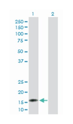 nudix (nucleoside diphosphate linked moiety X)-type motif 2, Rabbit, Purified