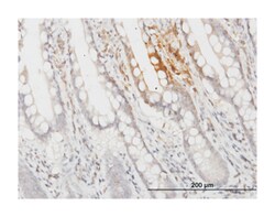 APOF, Mouse, Clone: 1D5, Abnova&trade;