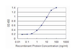 APCS, Mouse, Clone: 4E8, Abnova 100&mu;g; Unlabeled:Antibodies, Monoclonal