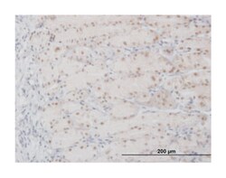 APEX nuclease (multifunctional DNA repair enzyme) 1 (B01), Mouse anti-Human,