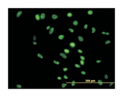 APEX nuclease (multifunctional DNA repair enzyme) 1 (B01), Mouse anti-Human,