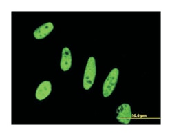 baculoviral IAP repeat-containing 5, Mouse, Clone: 5B10, Abnova 100&mu;g;