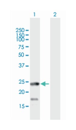 ADP-ribosylation factor-like 4D, Mouse, Polyclonal Antibody, Abnova 50&mu;L;