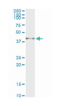 ARG2, Mouse, Clone: 3D10, Abnova&trade;