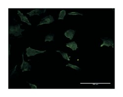 RHOC, Mouse, Clone: 1B7, Abnova 100&mu;g; Unlabeled:Antibodies, Monoclonal
