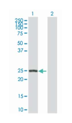 Rho GDP dissociation inhibitor (GDI) beta, Rabbit, Purified MaxPab Polyclonal