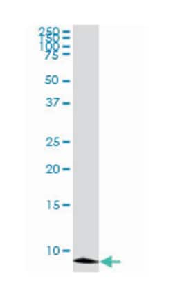 ATOX1, Mouse, Clone: 2E6, Abnova 100&mu;g; Unlabeled:Antibodies, Monoclonal