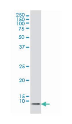 ATOX1, Mouse, Clone: 2E6, Abnova 100&mu;g; Unlabeled:Antibodies, Monoclonal