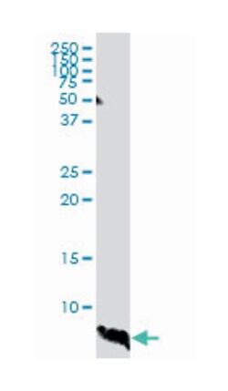 ATOX1, Mouse, Clone: 2E6, Abnova 100&mu;g; Unlabeled:Antibodies, Monoclonal