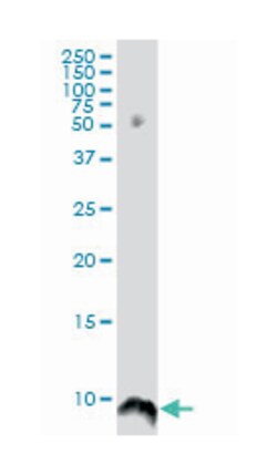 ATOX1, Mouse, Clone: 3E1, Abnova 100&mu;g; Unlabeled:Antibodies, Monoclonal