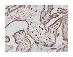 ATP6V1A, Mouse, Clone: 4F5, Abnova&trade;