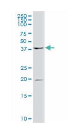 ATPase, H+ transporting, lysosomal 42kDa, V1 subunit C1, Mouse, Polyclonal