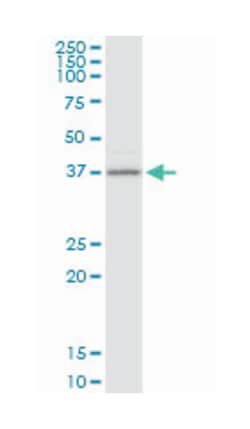 branched chain aminotransferase 2, mitochondrial, Mouse, Purified MaxPab