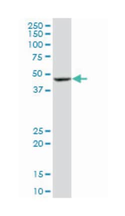 BLMH, Mouse, Clone: 4A2, Abnova 100&mu;g; Unlabeled:Antibodies, Monoclonal