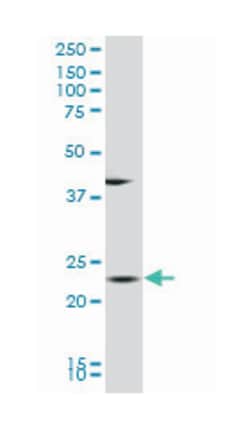 biliverdin reductase B (flavin reductase (NADPH)), Mouse, Polyclonal Antibody, Abnova 50 &mu;L | Buy Online | Abnova | Fisher Scientific