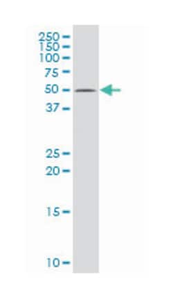 basal cell adhesion molecule (Lutheran blood group), Mouse, Polyclonal Antibody, Abnova 50 &mu;L | Buy Online | Abnova | Fisher Scientific