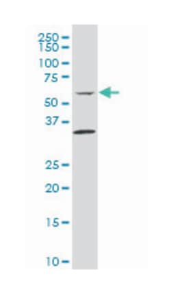 HLA-B associated transcript 5, Mouse, Polyclonal Antibody, Abnova 50 &mu;L | Buy Online | Abnova Corporation | Fisher Scientific