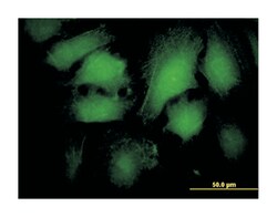 arrestin, beta 2, Mouse, Clone: 4D2, Abnova 100&mu;g; Unlabeled:Antibodies,
