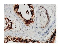ADP-ribosyltransferase 3, Mouse, Clone: 3A2, Abnova 100&mu;g; Unlabeled:Antibodies,