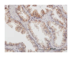 arginase, type II, Mouse, Purified MaxPab Polyclonal Antibody, Abnova 50&mu;g;