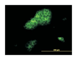 RHOA, Mouse, Clone: 1C10, Abnova 100&mu;g; Unlabeled:Antibodies, Monoclonal