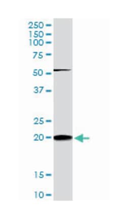 RHOC, Mouse, Clone: 2E12, Abnova 100&mu;g; Unlabeled:Antibodies, Monoclonal