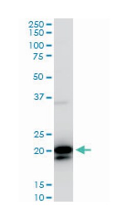 RHOC, Mouse, Clone: 1B7, Abnova 100&mu;g; Unlabeled:Antibodies, Monoclonal