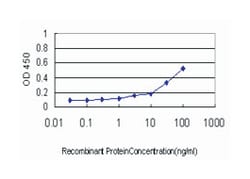 asparagine synthetase, Mouse, Clone: 3B3, Abnova 100 &mu;g | Buy Online | Abnova Corporation | Fisher Scientific
